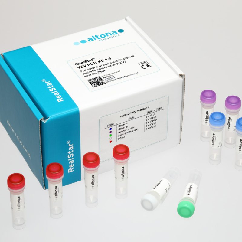 RealStar® VZV PCR Kit 1.0