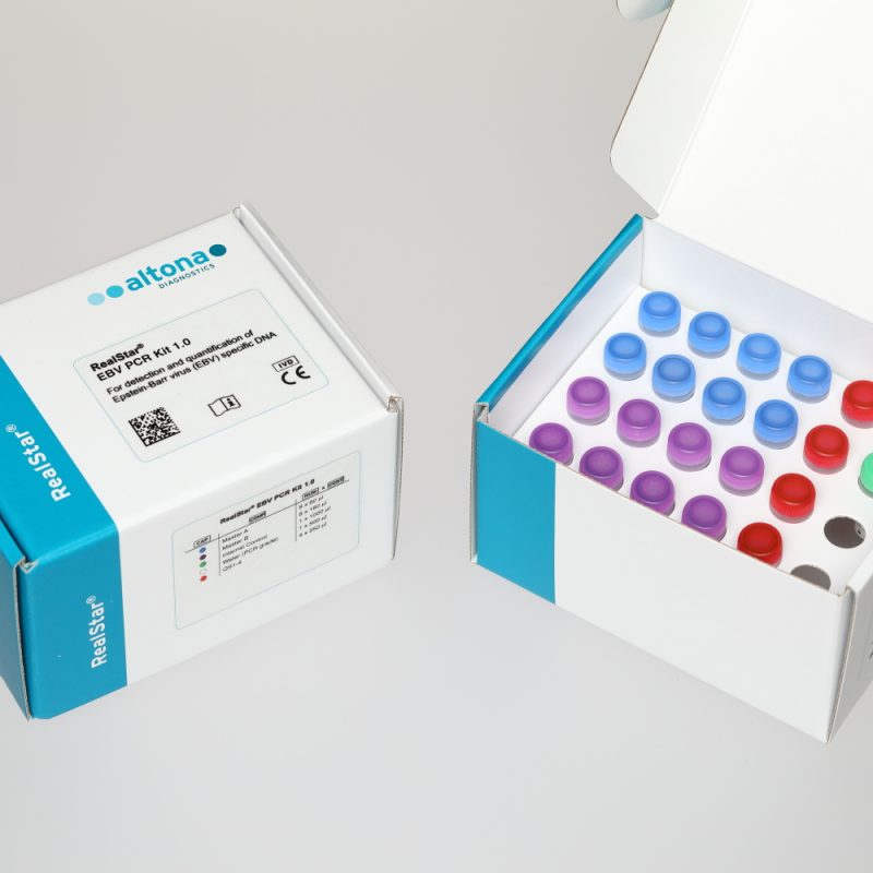 RealStar® EBV PCR Kit 1.0